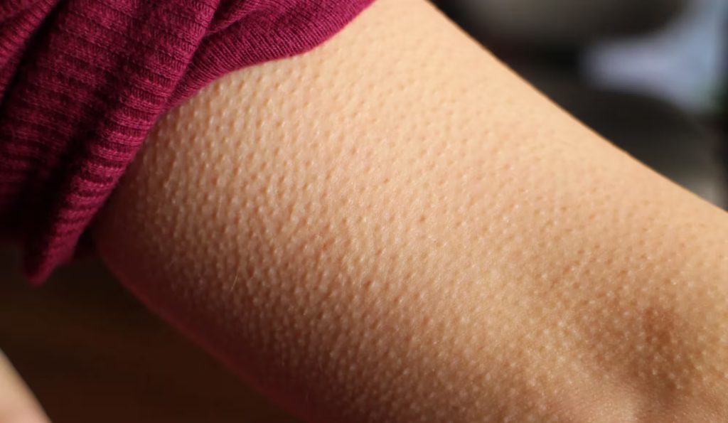 Why Music Gives Some People Chills and Leaves Others Unmoved